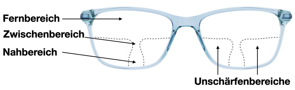 Kann man eine gleitsichtbrille durch Linsen ersetzen?
