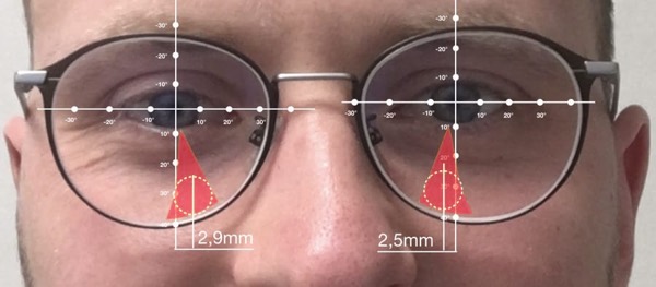 Gleitsichtbrille probleme lesebereich